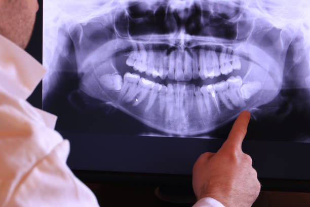 Best Emergency Dentist for Knocked-Out Tooth in Spring Mount, PA